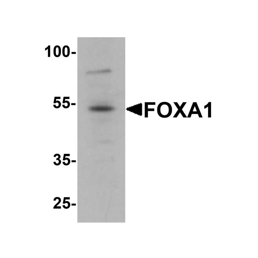 ProSci 7255 FOXA1 Antibody, ProSci, 0.1 mg/Unit Primary Image