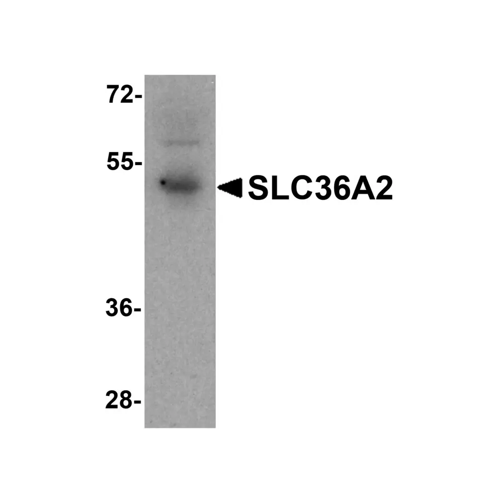 ProSci 8341_S SLC36A2 Antibody, ProSci, 0.02 mg/Unit Primary Image