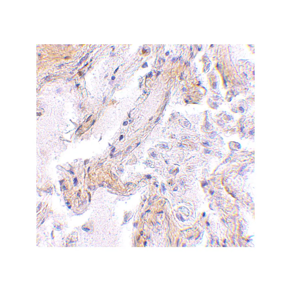 ProSci 4759_S CAPN6 Antibody, ProSci, 0.02 mg/Unit Secondary Image