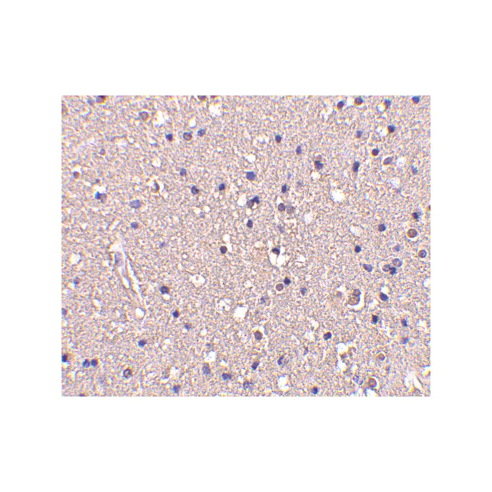 ProSci 3625 CRMP1 Antibody, ProSci, 0.1 mg/Unit Secondary Image