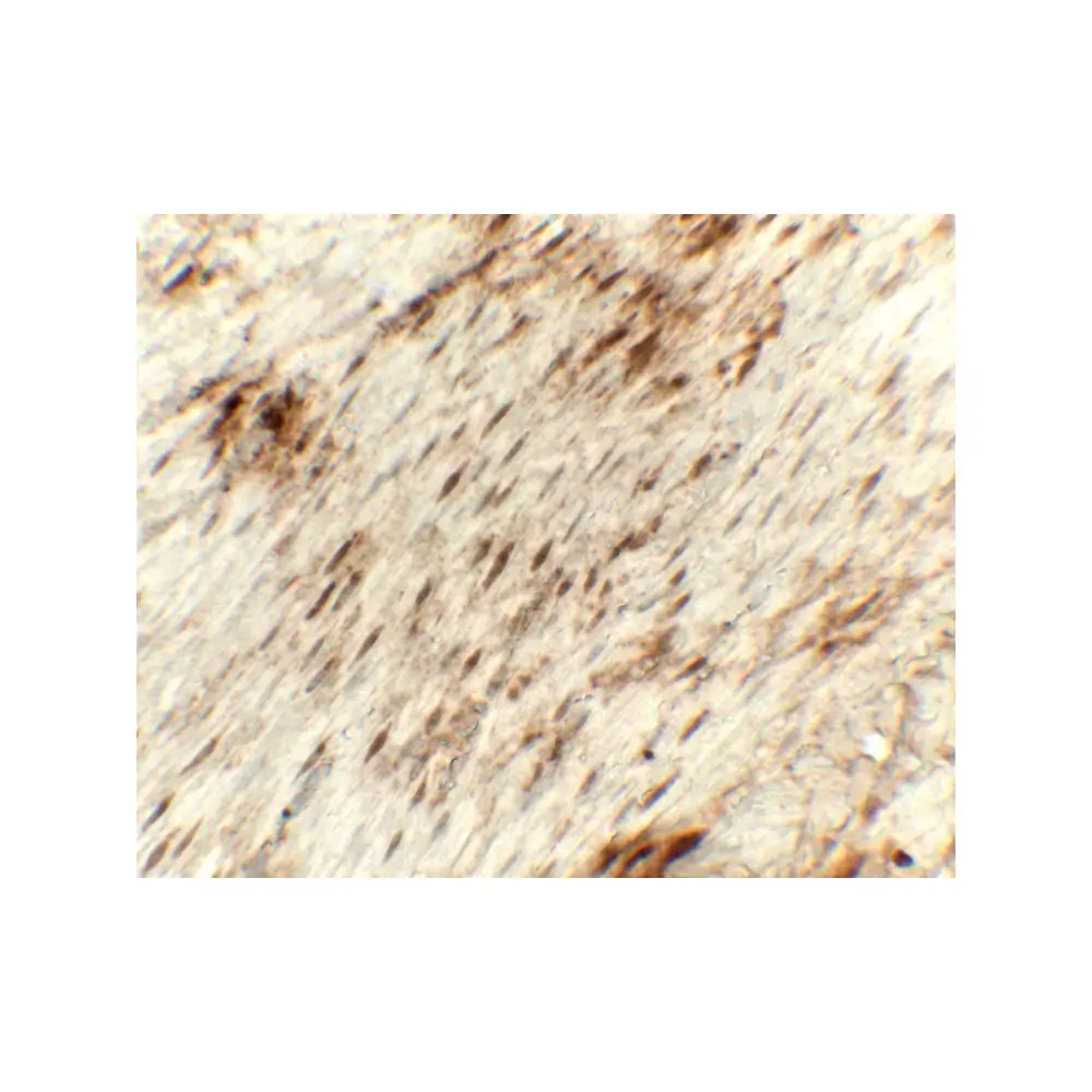 ProSci 8215_S GOLGIN97 Antibody, ProSci, 0.02 mg/Unit Secondary Image