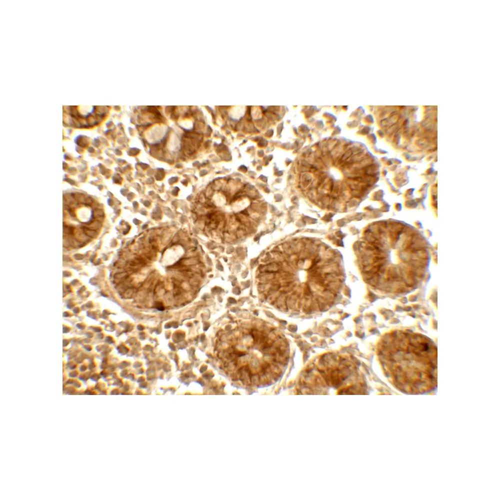 ProSci 7757 IFIT1 Antibody, ProSci, 0.1 mg/Unit Secondary Image