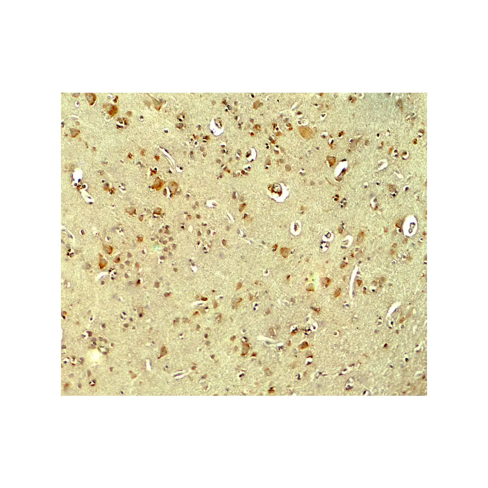 ProSci 7903_S PARK2 Antibody, ProSci, 0.02 mg/Unit Secondary Image