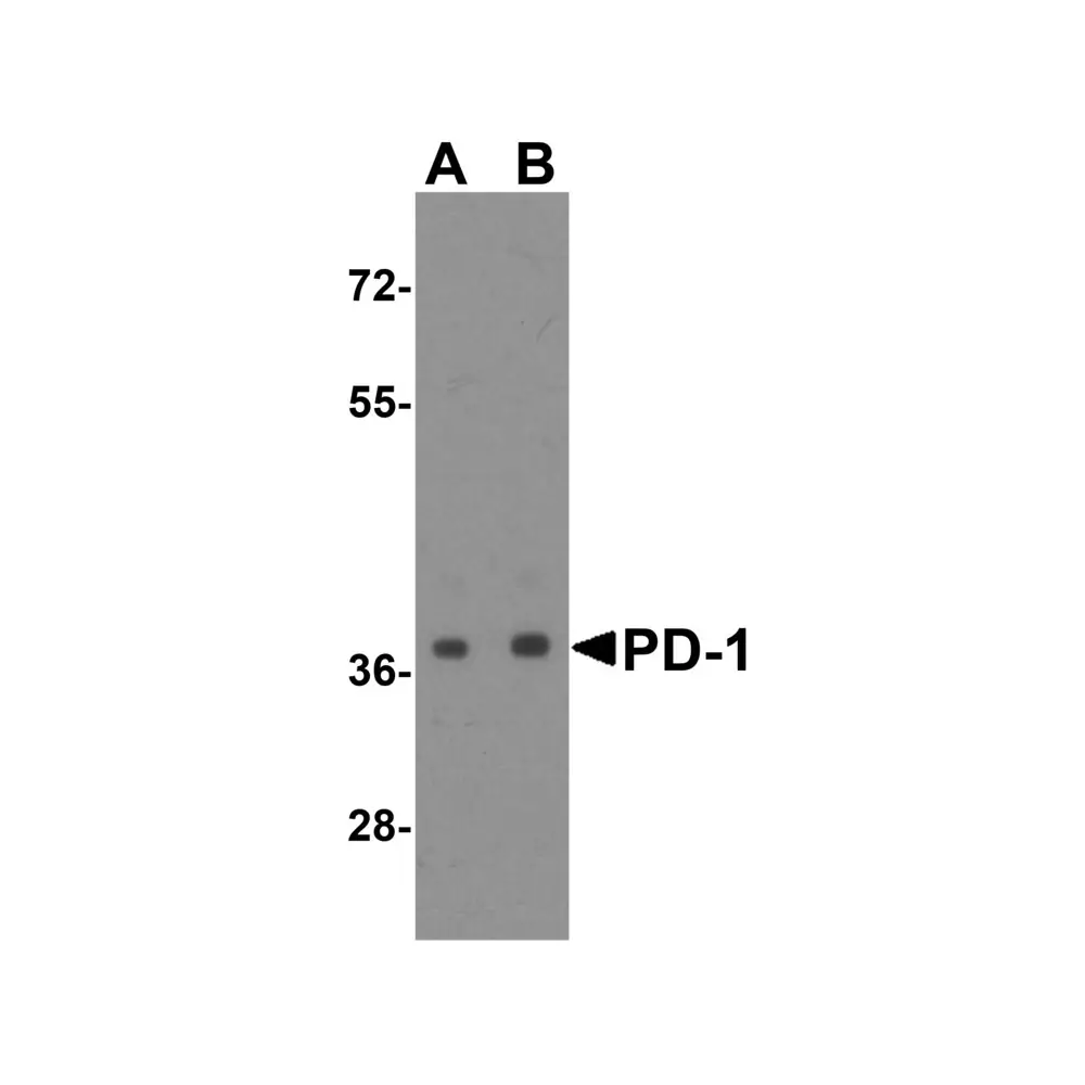ProSci RF16002_S PD1 Antibody [8A4], ProSci, 0.02 mg/Unit Primary Image