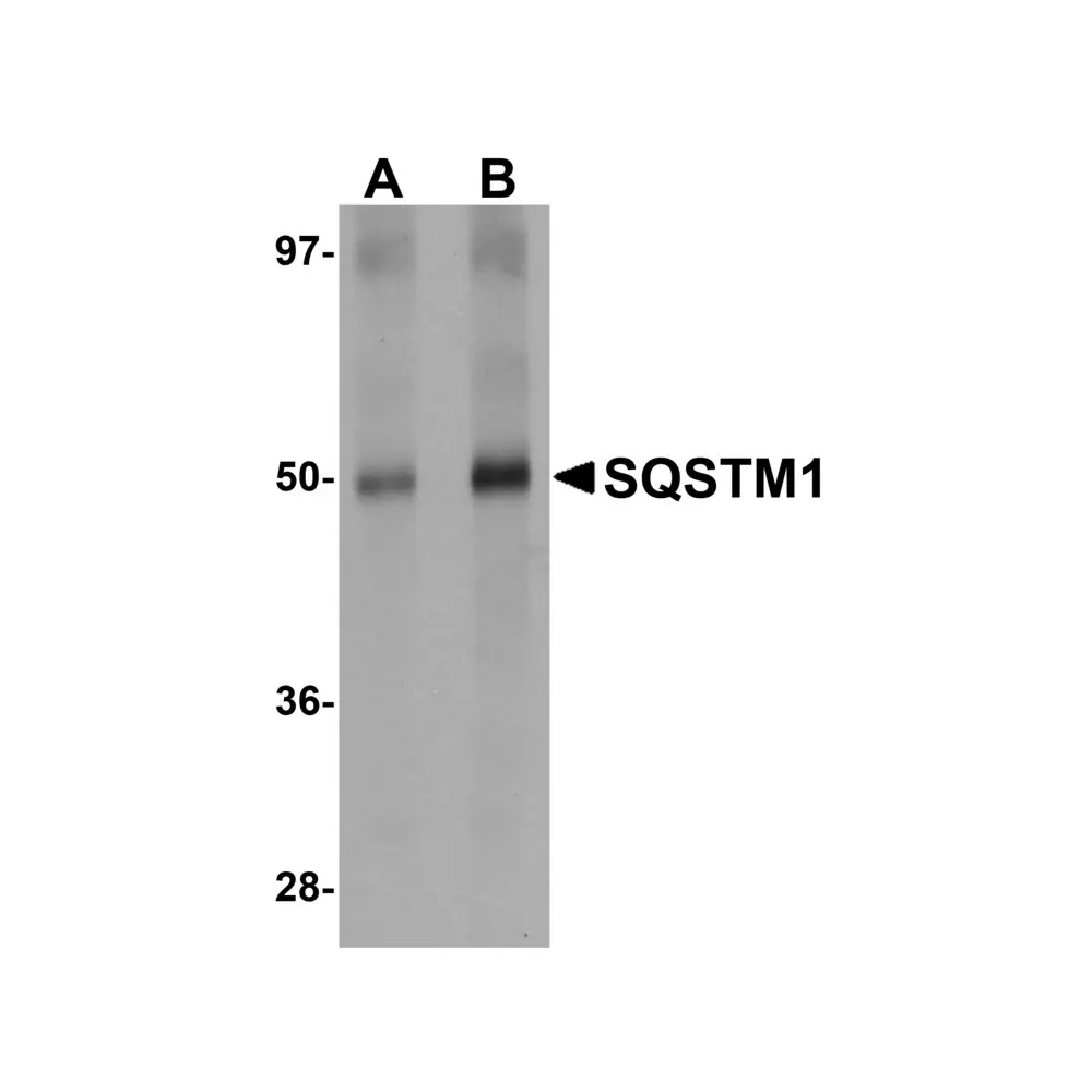 ProSci 5449 SQSTM1 Antibody, ProSci, 0.1 mg/Unit Quaternary Image