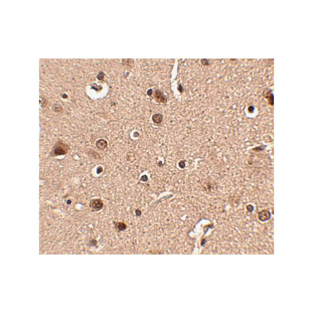 ProSci 4473_S Slitrk4 Antibody, ProSci, 0.02 mg/Unit Secondary Image